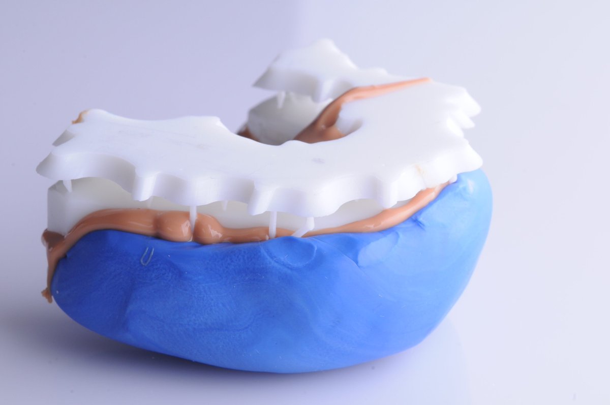 Digital Smile Design: как стоматологи моделируют новую улыбку с помощью 3D-технологий
